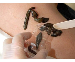 Leech Therapy Training Course