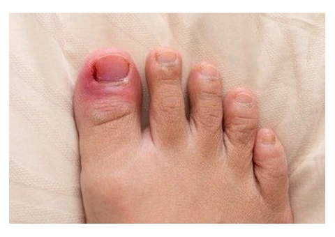 Care for Diabetic Toenails Today!