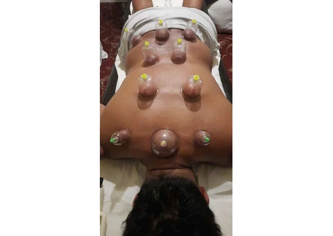 ???? Unveil the Ancient Art of Healing! Join Our Hijama Cupping Therapy Training Course ???? - 2/3