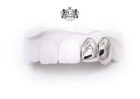Gold Grillz - 1/3