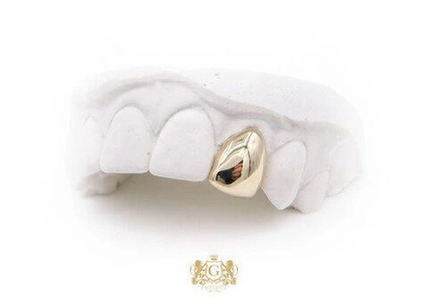 Gold Grillz - 2/3