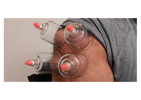 Where to Take Cupping Course in London and How to Enrol? - 3/3