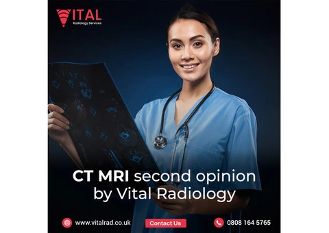CT MRI second opinion by Vital Radiology