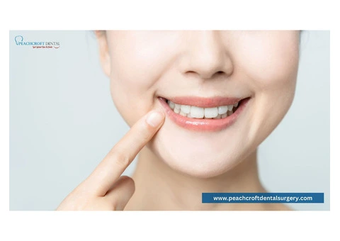 Reliable NHS Dentist Services in Abingdon - Affordable & Expert Care
