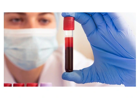 Get Accurate Results with Private Blood Tests at Our Clinic at Harley Street!