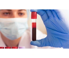 Get Accurate Results with Private Blood Tests at Our Clinic at Harley Street!