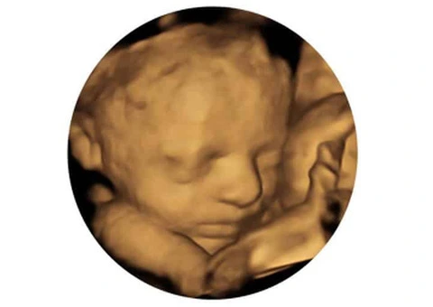Explore Exceptional Early Pregnancy Scans in the UK