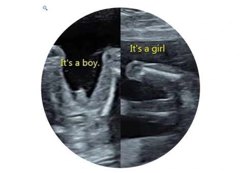 Explore Exceptional Early Pregnancy Scans in the UK - 2/2