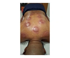 "Hijama Practitioner Certification: A Holistic Approach to Health"