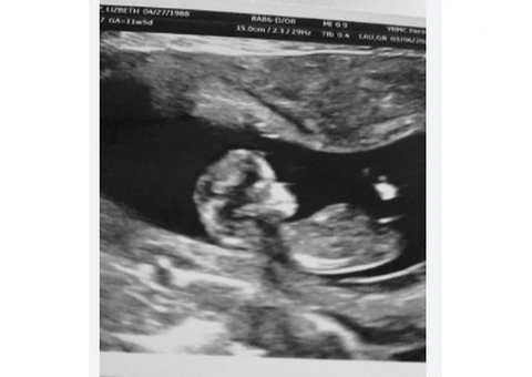 Fetal Well-Being Scan Services in Watford – Expert Care at Window to the Womb Clinic