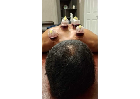 The Complete Hijama Cupping Practitioner Course