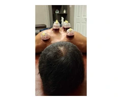 The Complete Hijama Cupping Practitioner Course