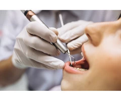 10 Tips On How To Find The Right Dentist For You