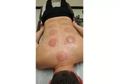 Holistic Healing with Hijama: Cupping Therapy Training - 2/2