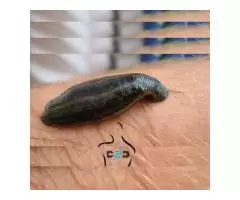 Advanced Techniques in Leech Therapy: A Holistic Healing Approach