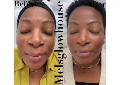 Experience Rejuvenating Facials at Our Beauty Salon in North London - 2/5