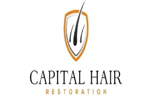 Capital Hair Restoration