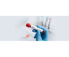 Think you might have contracted an STI?