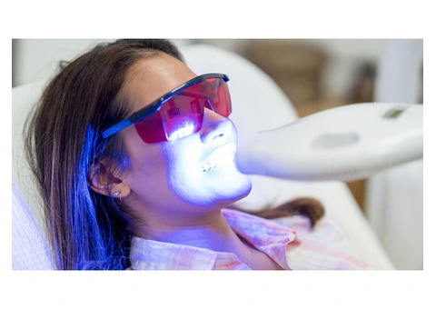Is Teeth Whitening Painful? Find Out the Truth