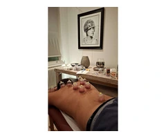 Cupping Therapy Unveiled: A Deep Dive into Hijama