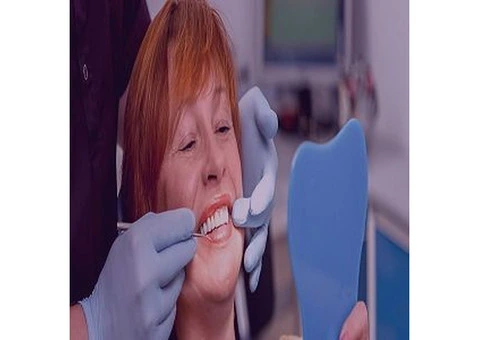Same Day Teeth Implants & All-on-Four Implants in Bromley | ConfiDental Care