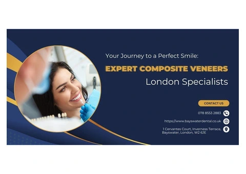 Your Journey to a Perfect Smile: Expert Composite Veneers London Specialists