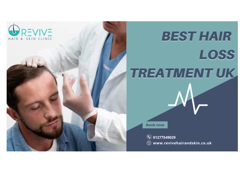 Best Hair Loss Treatment UK