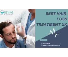 Best Hair Loss Treatment UK
