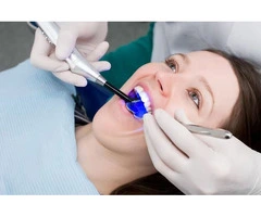 Looking to avail composite bonding in London?