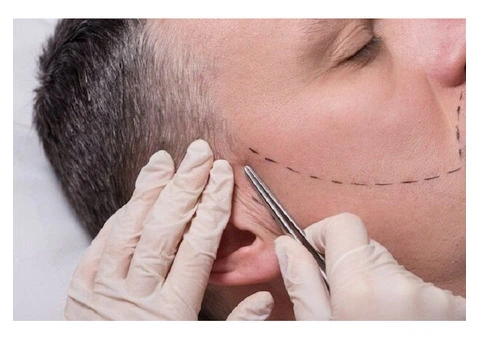 Get a Fuller Beard Today – Book Your Beard Transplant in the UK!