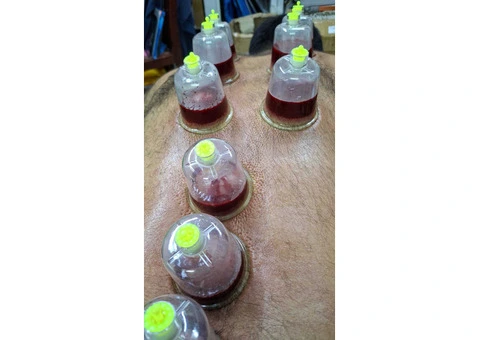 Holistic Healing with Hijama: Cupping Therapy Masterclassv - 2/2