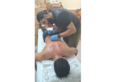 Mastering the Ancient Art of Hijama Cupping