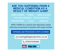 CASTING PEOPLE WITH WEIGHT-RELATED MEDICAL CONDITIONS FOR NEW MEDICAL SERIES
