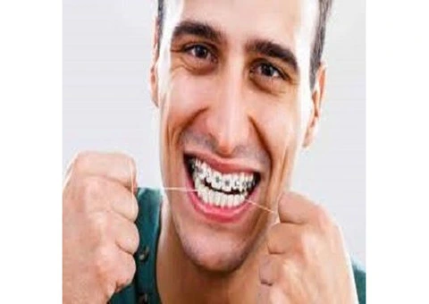 Adult Braces and Cosmetic Braces at ConfiDental Care
