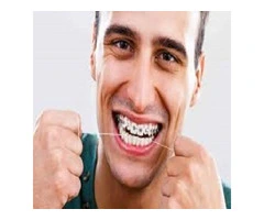 Adult Braces and Cosmetic Braces at ConfiDental Care