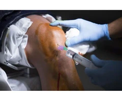 Expert Meniscal Injury Surgery in Manchester – Regain Pain-Free Movement!