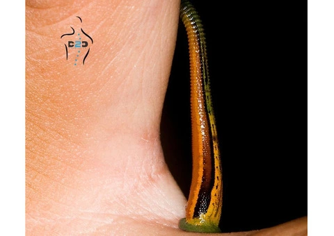 Leech Therapy for Wellness: Hands-On Training and Certification