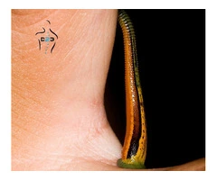 Leech Therapy for Wellness: Hands-On Training and Certification