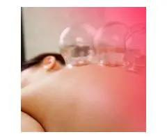 The Complete Hijama Cupping Practitioner’s Course