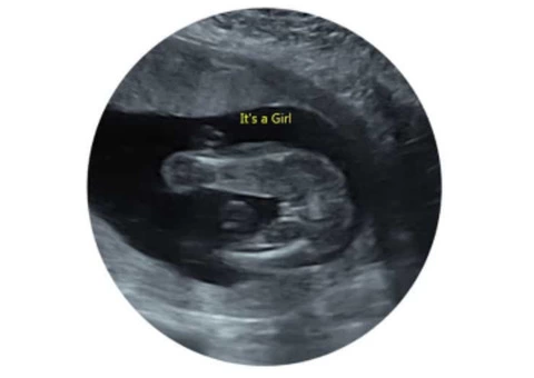 99.99% accurate baby gender scan clinic in Milton Keynes