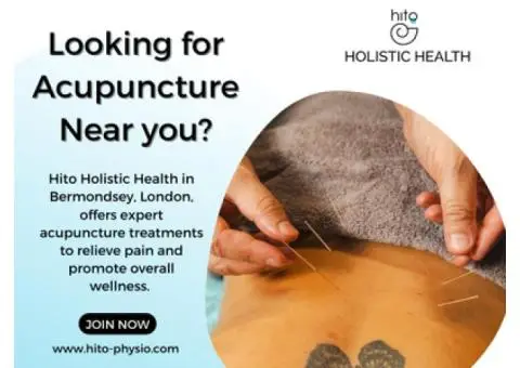 Looking For Acupuncture Near You?