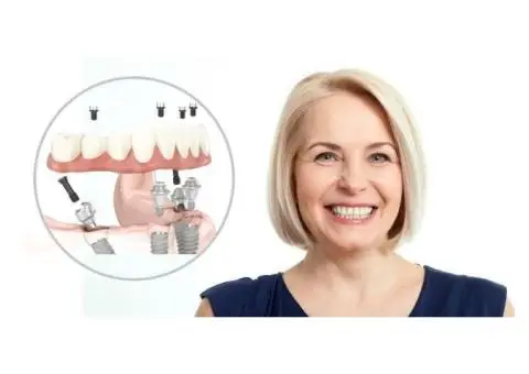 Missing Teeth? Dental Implants from £78/Month