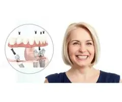 Missing Teeth? Dental Implants from £78/Month