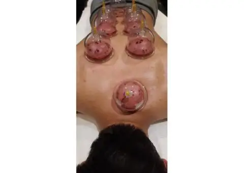 Advanced Hijama Cupping: Techniques for Effective Healing - 2/3