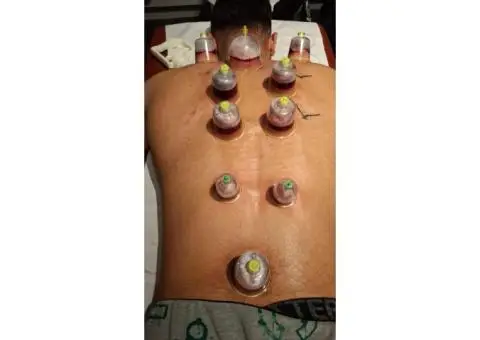 Advanced Hijama Training for Professionals