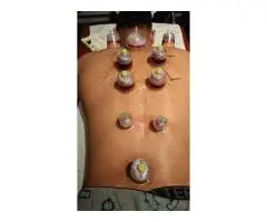 Advanced Hijama Training for Professionals