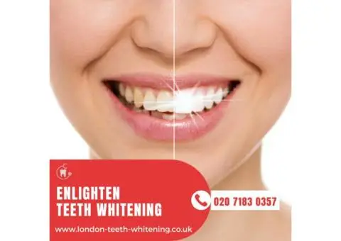 Professional Laser Teeth Whitening in London – Instant Results!
