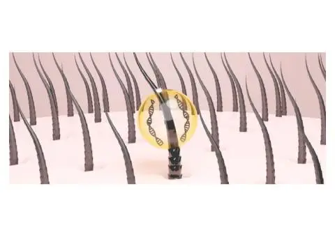 Stem Cell Hair Follicle Regeneration Treatment in London | Levitas Aesthetics