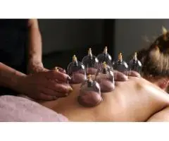 Cupping Therapy for Pain Relief – Book Today