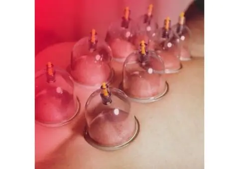 A Deep Dive into Hijama: Unlock the Power of Cupping - 2/2